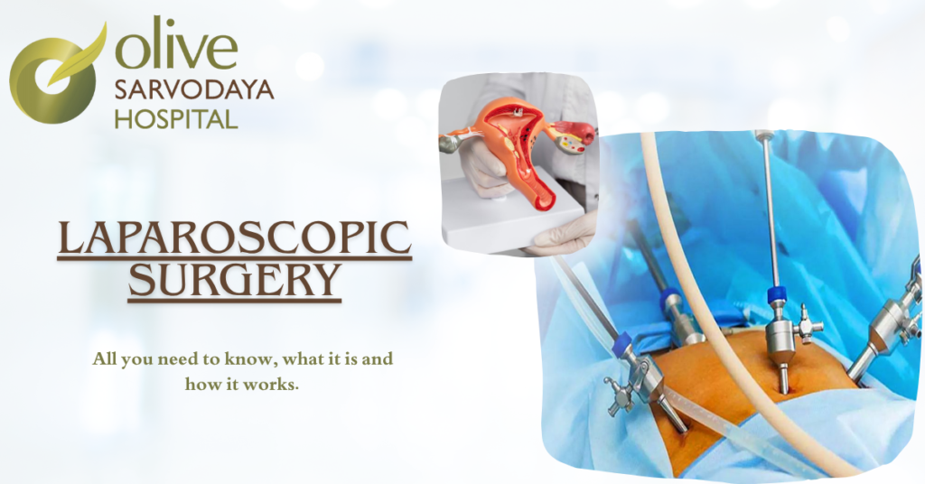 best laparoscopic surgeon in Hyderabad
